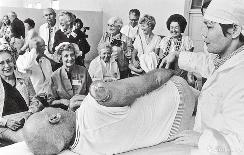 安哥作品：1985·广东湛江　外国游客在中医院尝试拔火罐